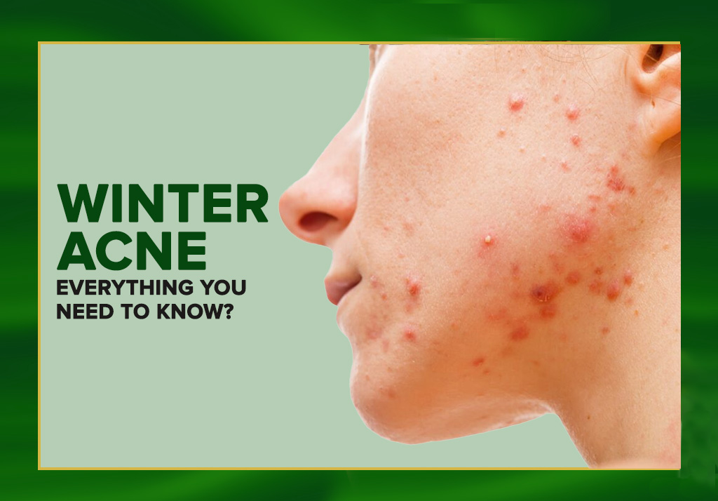 Winter Acne